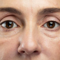 Q&amp;A with Katrina Hansen, DO, FAAD: How to Combat Aging Skin Around the Eyes